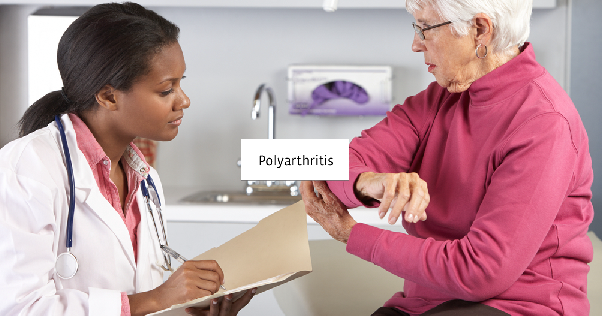 osteoarthritis polyosteoarthritis)